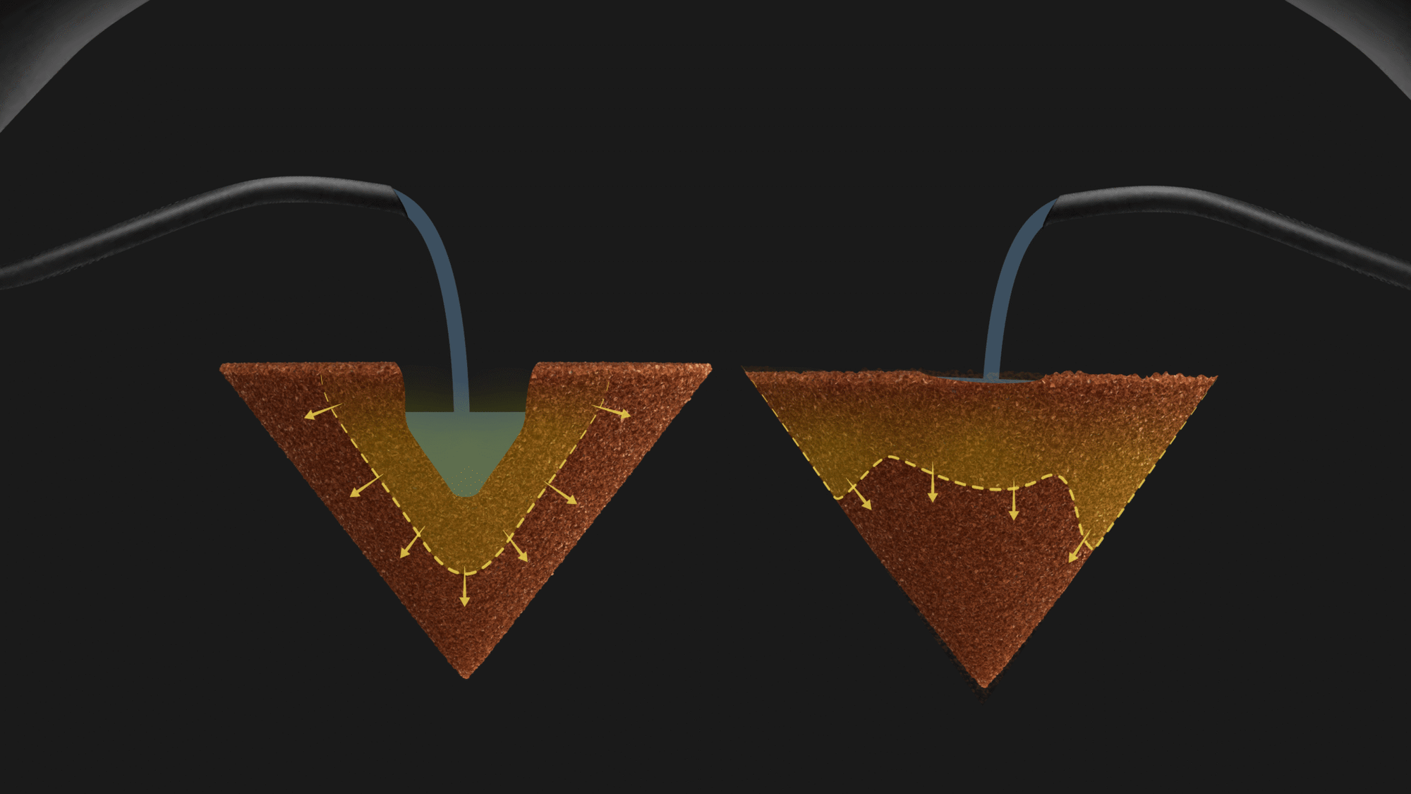 Nucleus Bloom Black With 15 Needles  WDT Tool