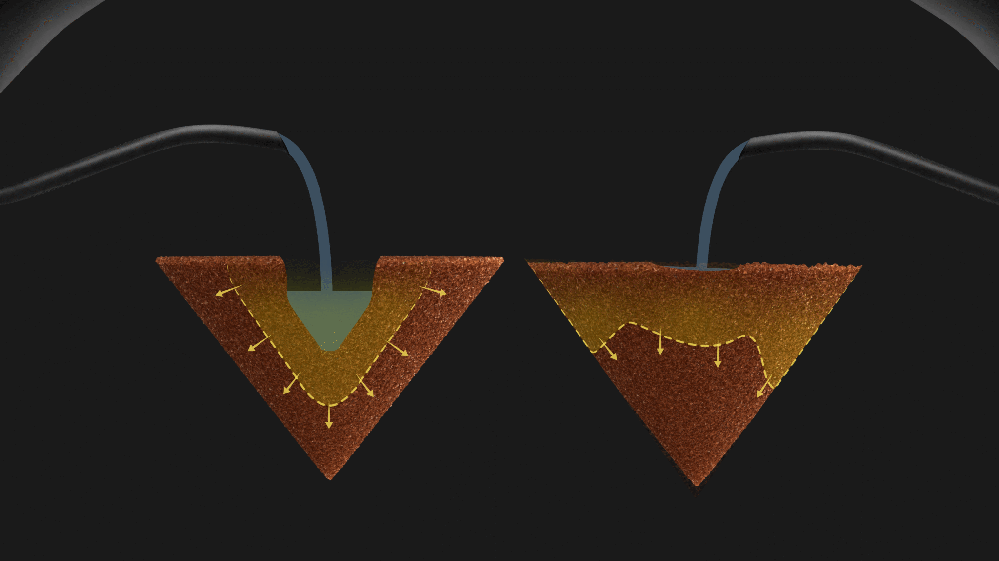 Nucleus Bloom Black With 15 Needles  WDT Tool